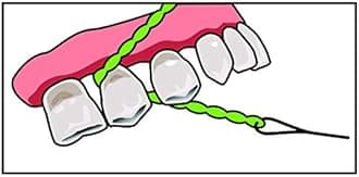 Idontix X-Floss 30 Strands Easy Bridge And Implant Floss by Idontix
