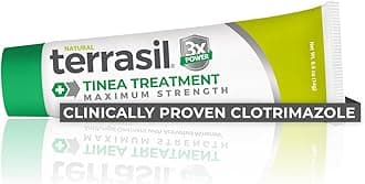 - Tinea Versicolor Treatment Cream Max Strength, Antifungal Tinea Cream, Clinically Proven 1% Clotrimazole, Treats Most Ringworm & Fungal Infections, Soothing Relief of Itchy Dry Skin (.5oz)