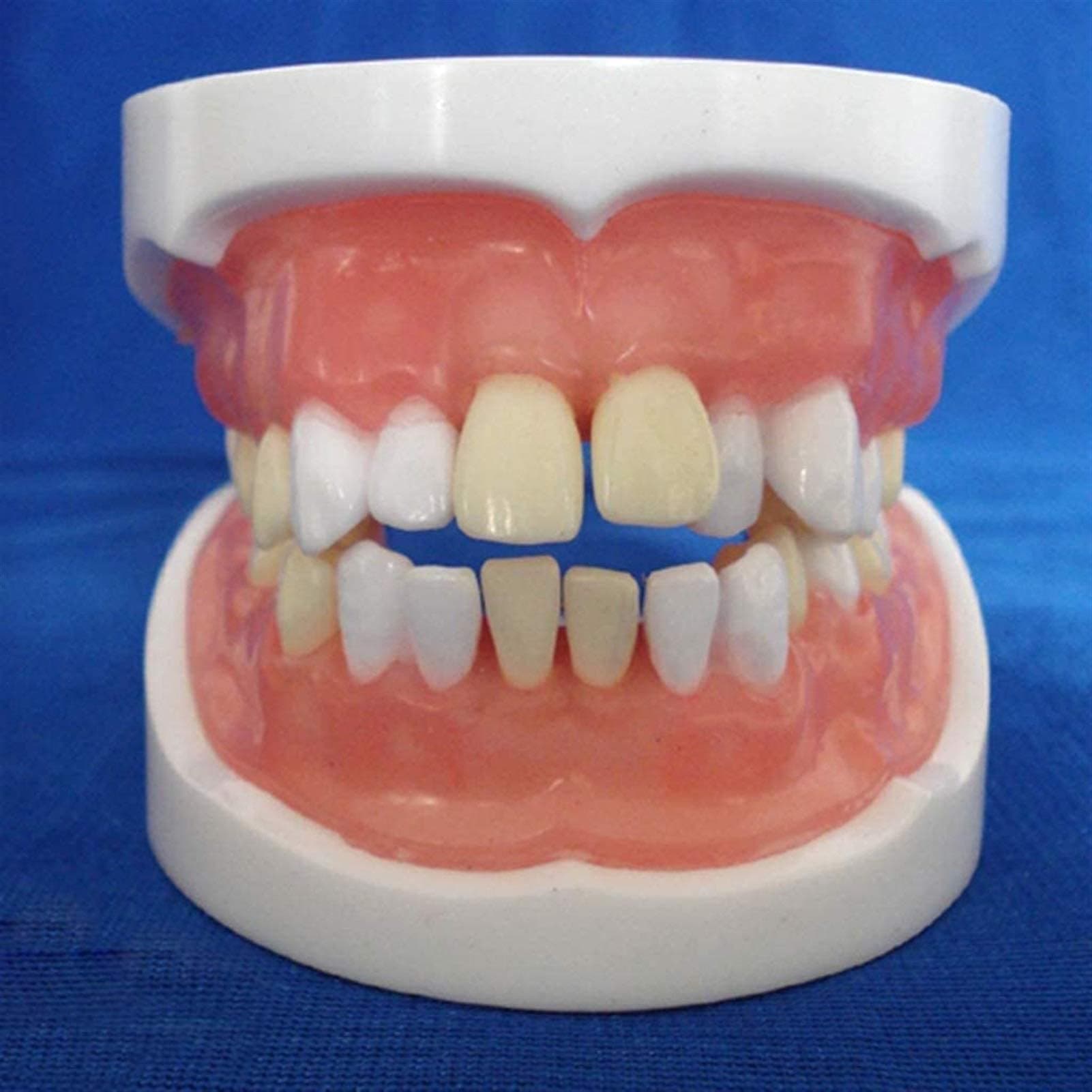 WZXCV Study Model Educational Model Dental Teeth Anatomical Model - Teeth Oral Model - Medical Anatomical Tooth Extraction Model - For Educational Oral Human Teeth Training Model