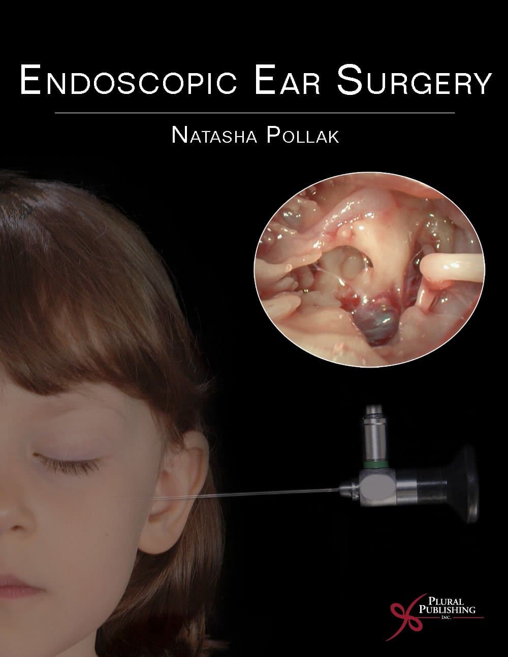 Endoscopic Ear Surgery 1st Edition